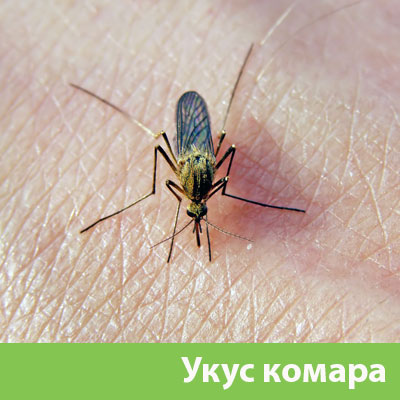 Укусы комаров в Тобольске