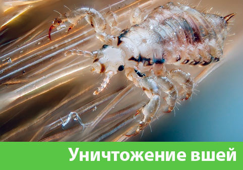 Уничтожение вшей в городе Тобольск